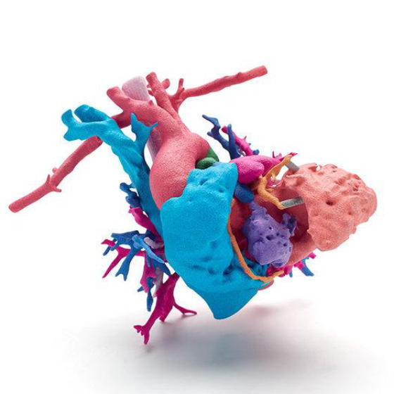 This full color model is a heart of a young girl named Jemma with a complex heart defect; the heart was printed using HP’s new Jet Fusion 300 / 500 3D printer to help surgeons at Phoenix Children’s Hospital prepare, select the best surgical path and explain the procedure to Jemma’s family. | Data courtesy of Phoenix Children’s Hospital; Heart of Jemma