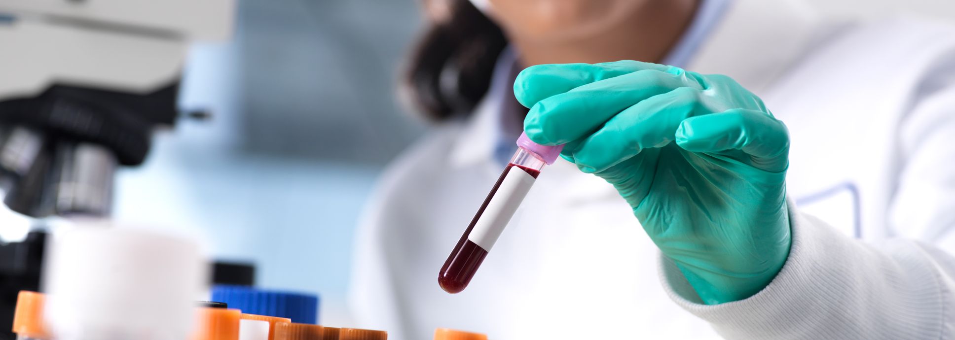An image of a laboratory professional holding a test tube filled with blood.
