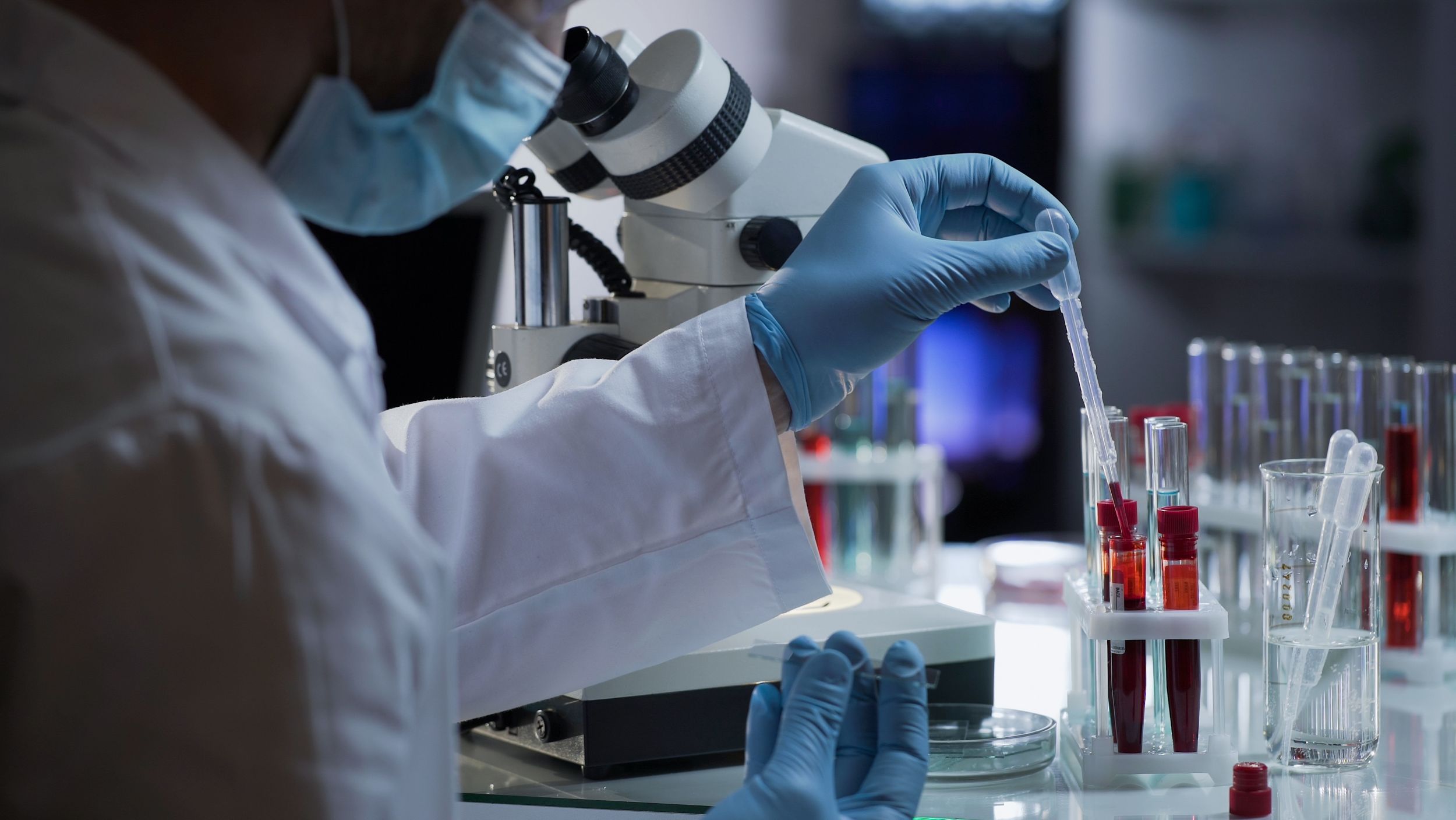 Laboratory assistant taking drop of blood to detect antibodies and infections