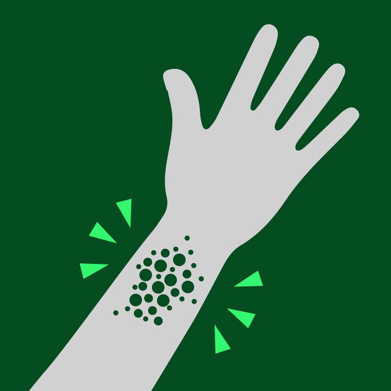 Illustration of body reacting to allergens