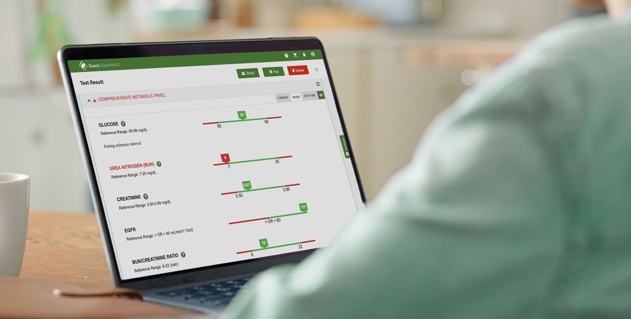Will Quest Diagnostics Give Me My Results This Weekend? - t1zlow7
