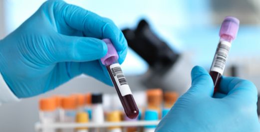 Laboratory worker handling transplant testing specimens