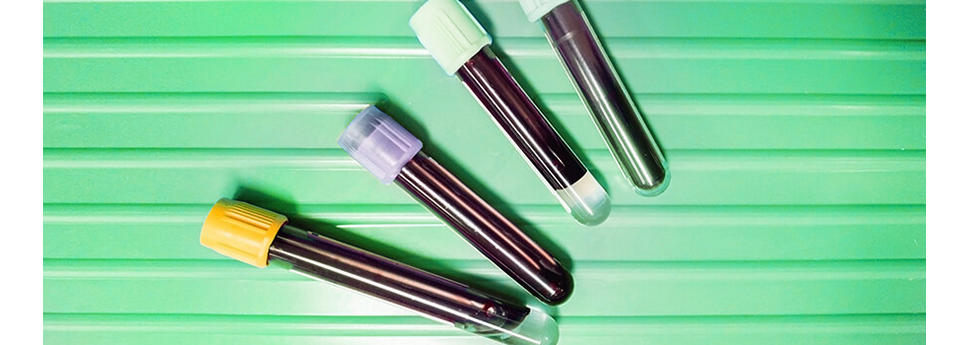 Test tubes of blood