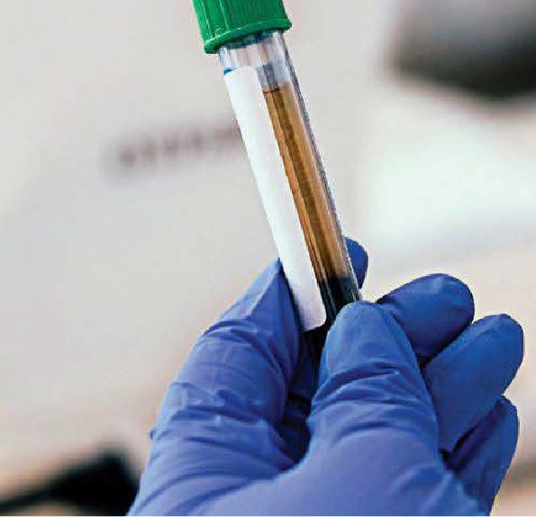 IDI lab tube