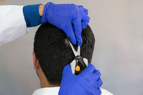 Hair Drug Testing & Screening | Quest Diagnostics