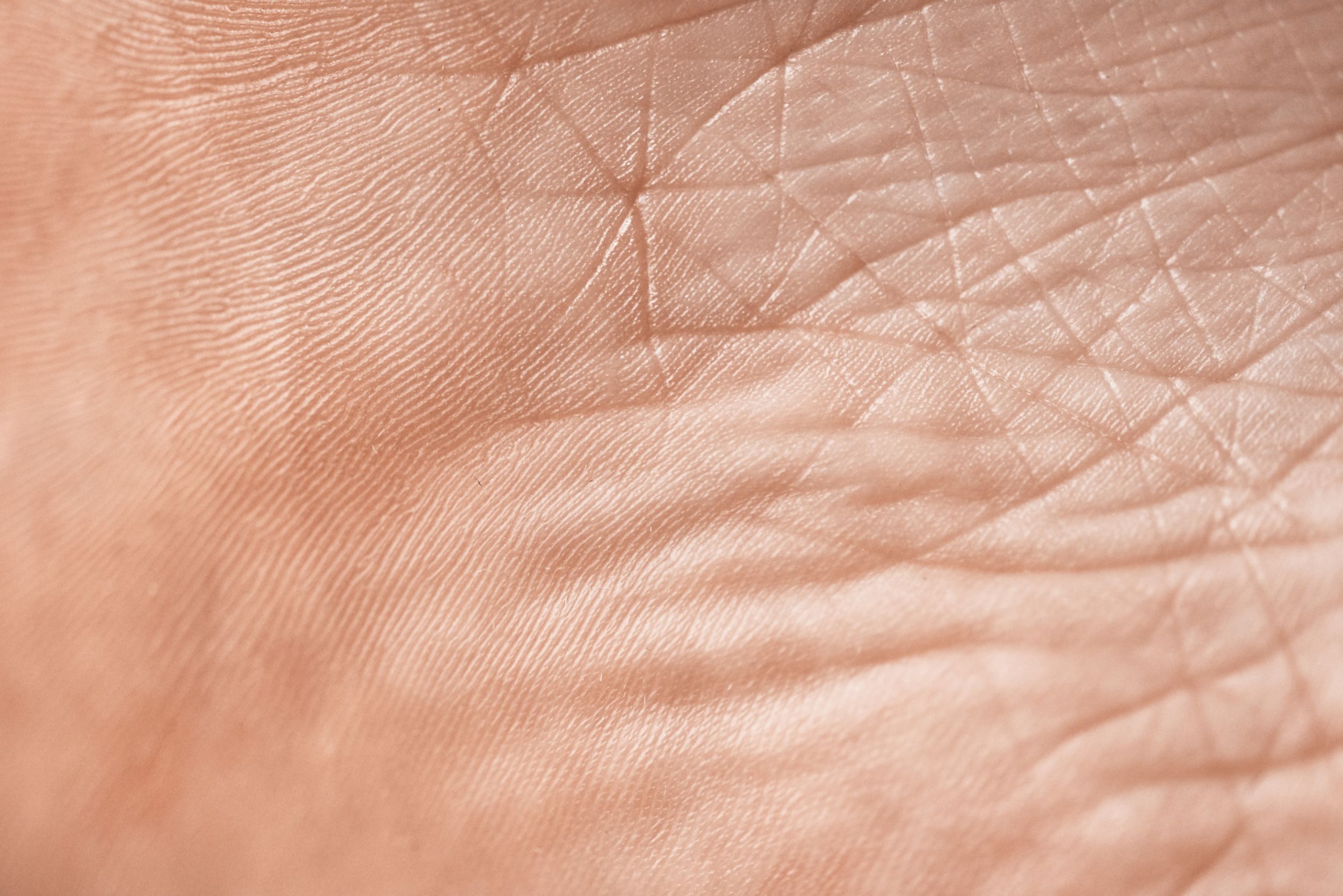 Closeup photo of skin